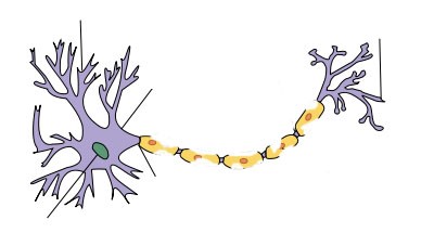 Два нейрона: один - здоровый, второй – повреждённый